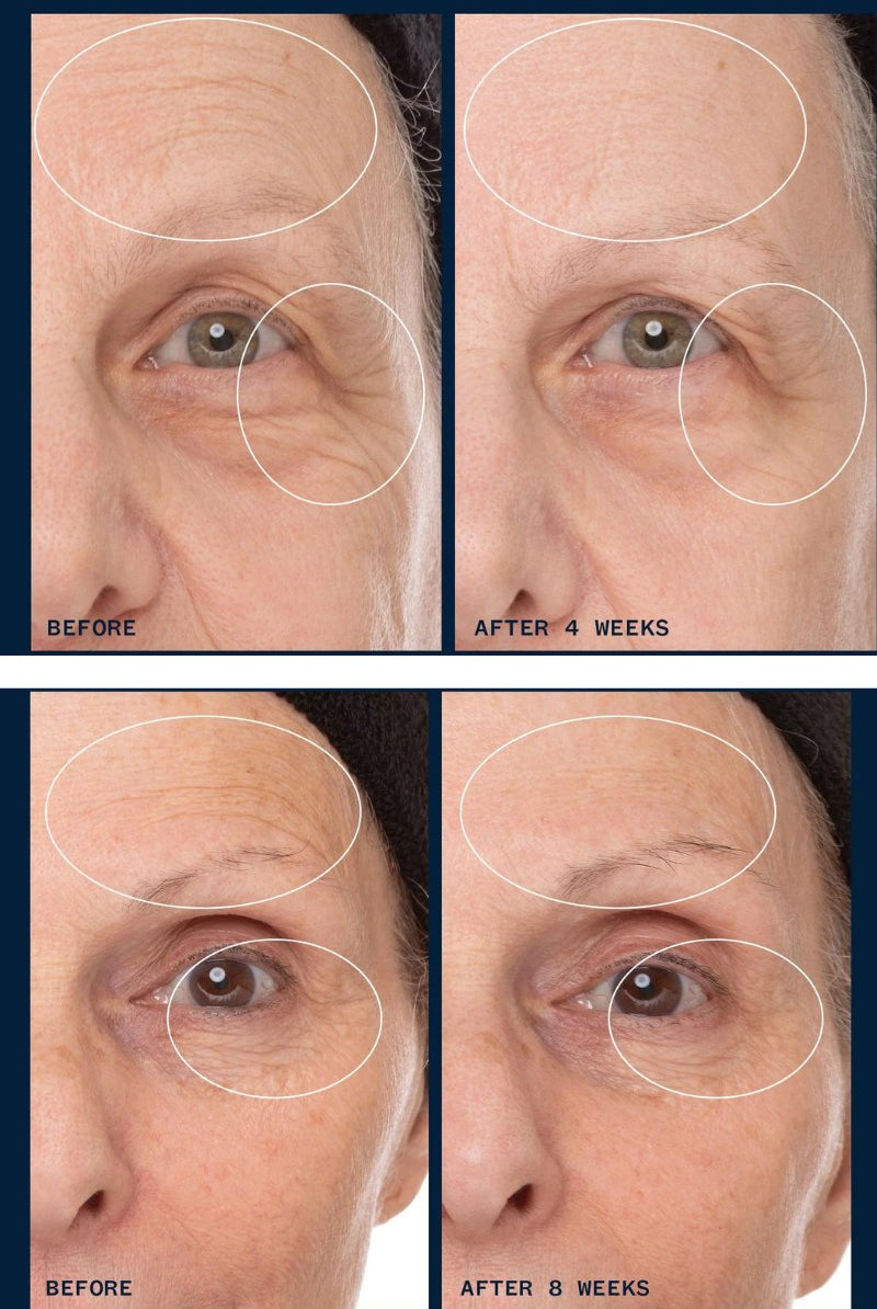 Lunar Bloom Retinal - Ursa Major - Archery Close